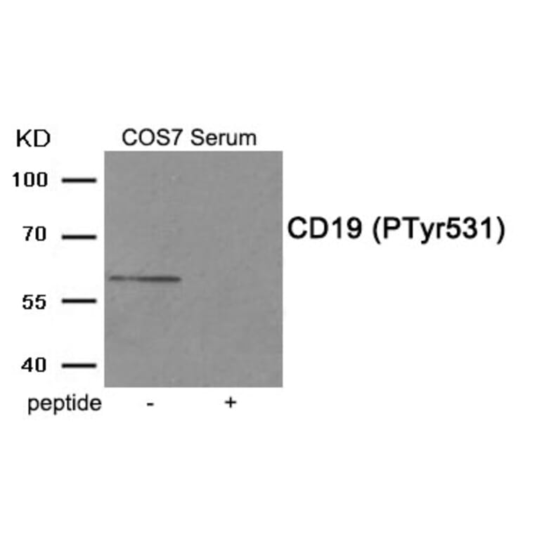 Western blot - CD19 (Phospho-Tyr531) Antibody from Signalway Antibody (11910) - Antibodies.com