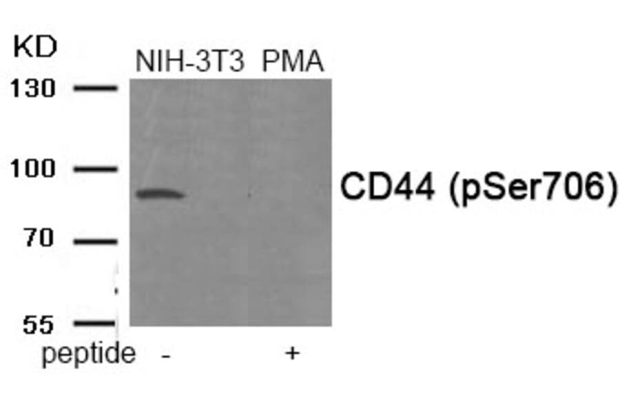 Western blot - CD44 (Phospho-Ser706) Antibody from Signalway Antibody (11911) - Antibodies.com