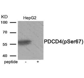 Western blot - PDCD4 (Phospho-Ser67) Antibody from Signalway Antibody (11925) - Antibodies.com