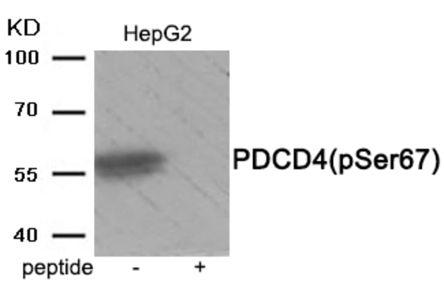 Western blot - PDCD4 (Phospho-Ser67) Antibody from Signalway Antibody (11925) - Antibodies.com