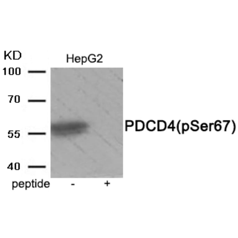 Western blot - PDCD4 (Phospho-Ser67) Antibody from Signalway Antibody (11925) - Antibodies.com