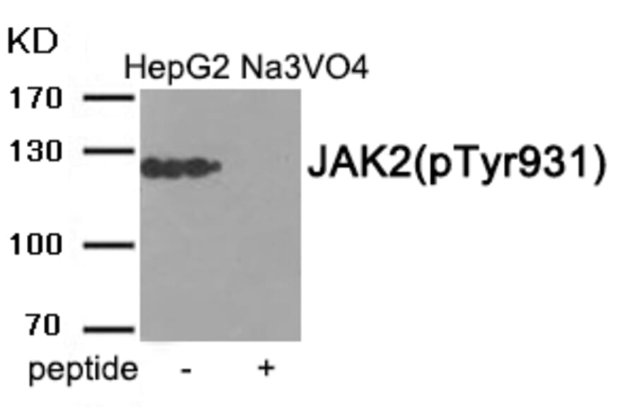 Western blot - JAK2 (Phospho-Tyr931) Antibody from Signalway Antibody (11932) - Antibodies.com