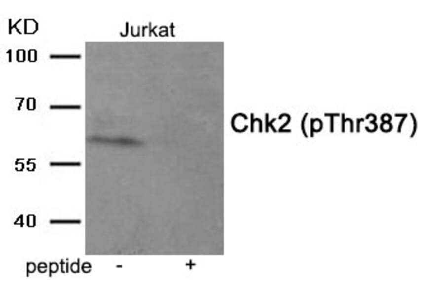 Western blot - Chk2 (Phospho-Thr387) Antibody from Signalway Antibody (11934) - Antibodies.com