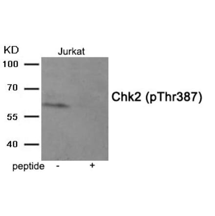 Western blot - Chk2 (Phospho-Thr387) Antibody from Signalway Antibody (11934) - Antibodies.com
