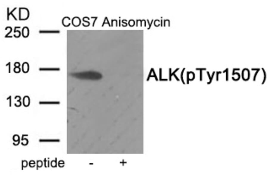 Western blot - ALK (Phospho-Tyr1507) Antibody from Signalway Antibody (11966) - Antibodies.com