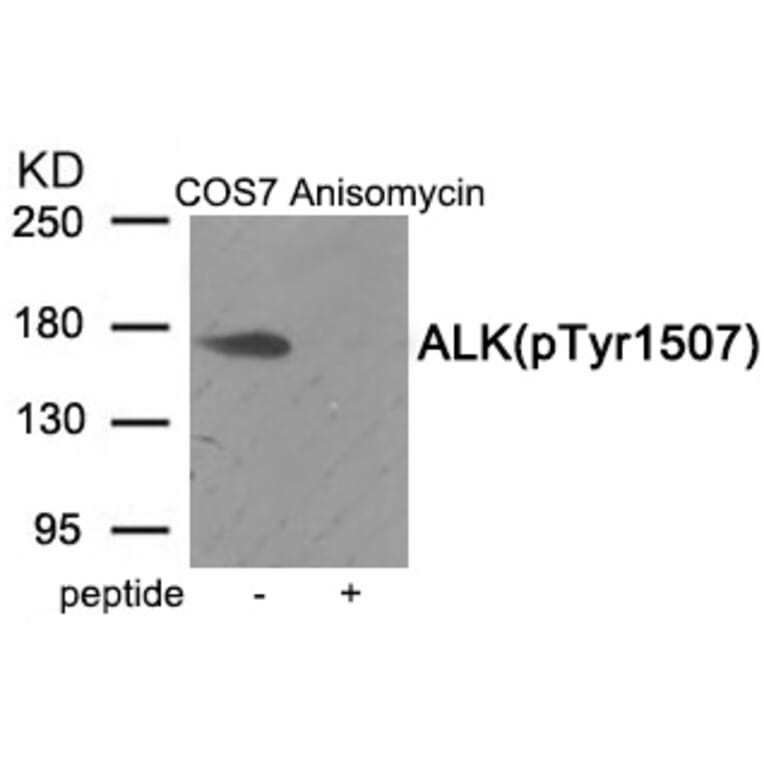 Western blot - ALK (Phospho-Tyr1507) Antibody from Signalway Antibody (11966) - Antibodies.com