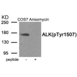 Western blot - ALK (Phospho-Tyr1507) Antibody from Signalway Antibody (11966) - Antibodies.com