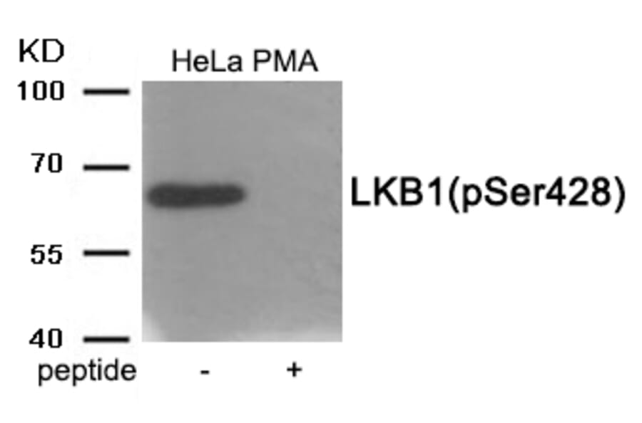 Western blot - LKB1 (Phospho-Ser428) Antibody from Signalway Antibody (11980) - Antibodies.com