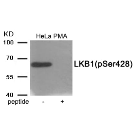 Western blot - LKB1 (Phospho-Ser428) Antibody from Signalway Antibody (11980) - Antibodies.com