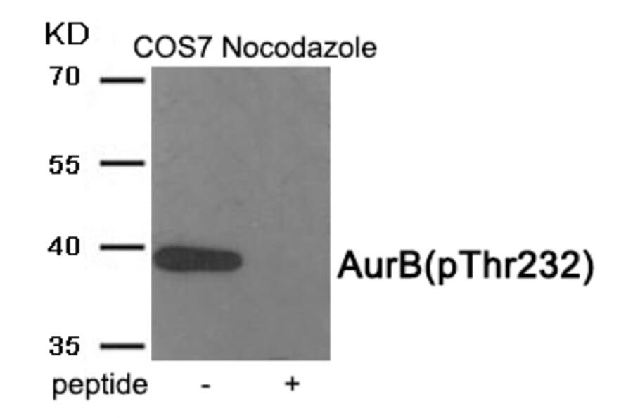 Western blot - AurB (Phospho-Thr232) Antibody from Signalway Antibody (11982) - Antibodies.com