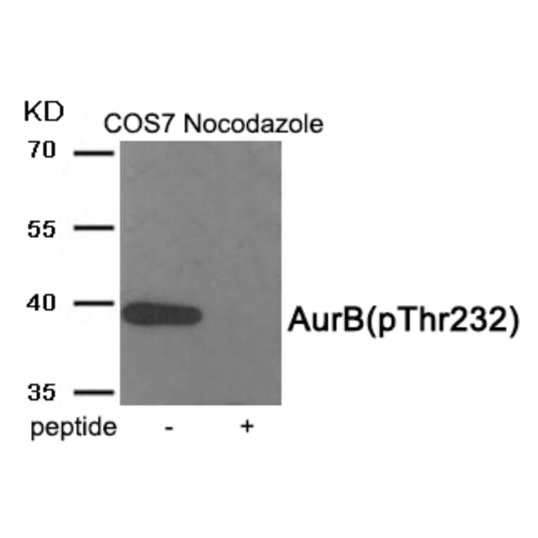 Western blot - AurB (Phospho-Thr232) Antibody from Signalway Antibody (11982) - Antibodies.com