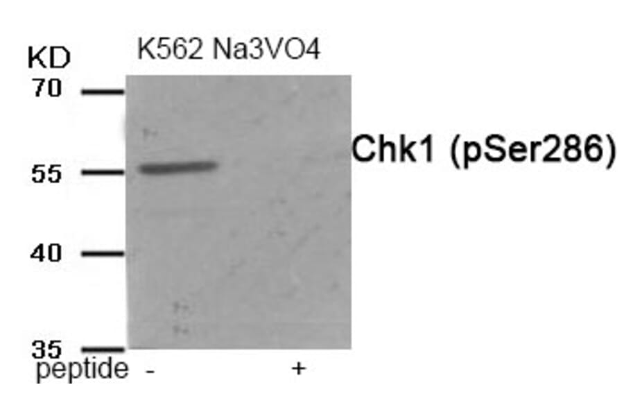 Western blot - Chk1 (Phospho-Ser286) Antibody from Signalway Antibody (11987) - Antibodies.com