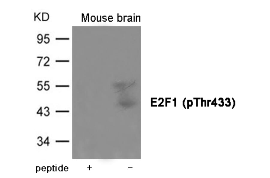 Western blot - E2F1 (Phospho-Thr433) Antibody from Signalway Antibody (12006) - Antibodies.com