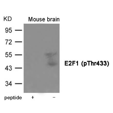 Western blot - E2F1 (Phospho-Thr433) Antibody from Signalway Antibody (12006) - Antibodies.com