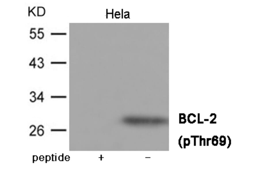 Western blot - BCL-2 (Phospho-Thr69) Antibody from Signalway Antibody (12036) - Antibodies.com
