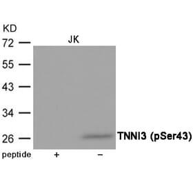 Western blot - TNNI3 (Phospho-Ser43) Antibody from Signalway Antibody (12040) - Antibodies.com