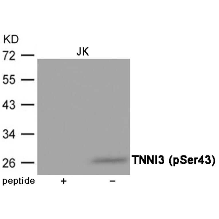 Western blot - TNNI3 (Phospho-Ser43) Antibody from Signalway Antibody (12040) - Antibodies.com