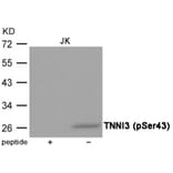 Western blot - TNNI3 (Phospho-Ser43) Antibody from Signalway Antibody (12040) - Antibodies.com