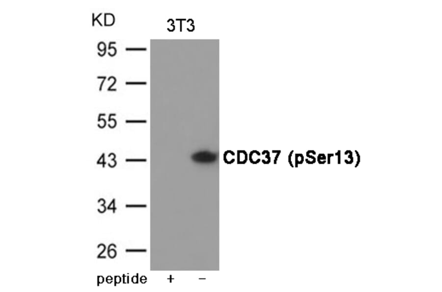 Western blot - CDC37 (Phospho-Ser13) Antibody from Signalway Antibody (12049) - Antibodies.com