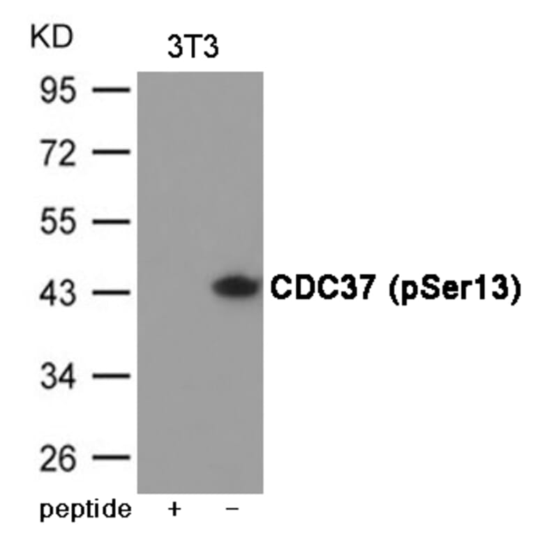 Western blot - CDC37 (Phospho-Ser13) Antibody from Signalway Antibody (12049) - Antibodies.com