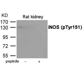 Western blot - iNOS (Phospho-Tyr151) Antibody from Signalway Antibody (12067) - Antibodies.com