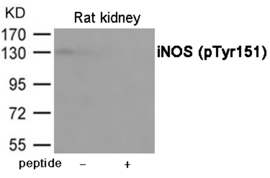 Western blot - iNOS (Phospho-Tyr151) Antibody from Signalway Antibody (12067) - Antibodies.com