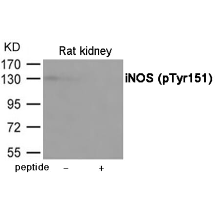 Western blot - iNOS (Phospho-Tyr151) Antibody from Signalway Antibody (12067) - Antibodies.com