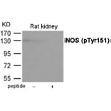 Western blot - iNOS (Phospho-Tyr151) Antibody from Signalway Antibody (12067) - Antibodies.com