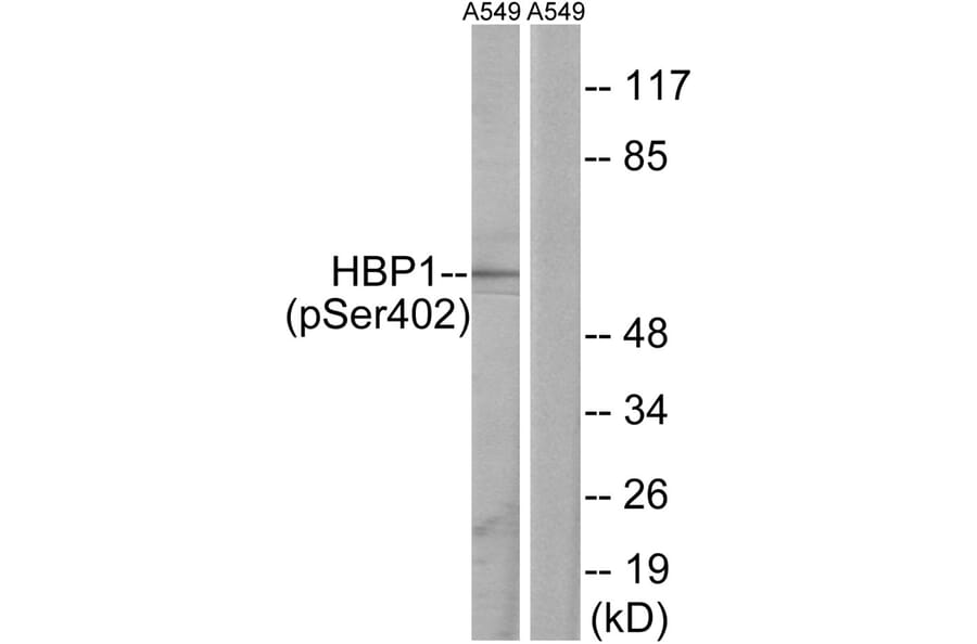Western blot - HBP1 (Phospho-Ser402) Antibody from Signalway Antibody (12107) - Antibodies.com