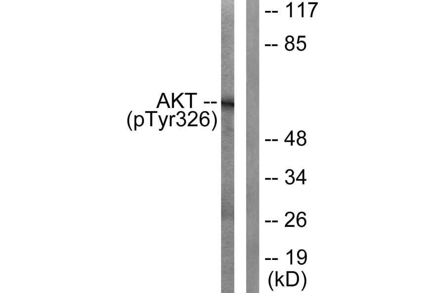 Western blot - Akt (Phospho-Tyr326) Antibody from Signalway Antibody (12126) - Antibodies.com