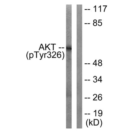 Western blot - Akt (Phospho-Tyr326) Antibody from Signalway Antibody (12126) - Antibodies.com