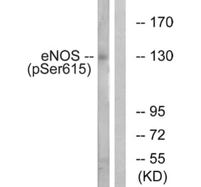 Western blot - eNOS (Phospho-Ser615) Antibody from Signalway Antibody (12137) - Antibodies.com