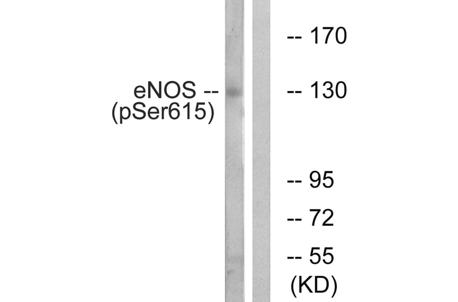 Western blot - eNOS (Phospho-Ser615) Antibody from Signalway Antibody (12137) - Antibodies.com