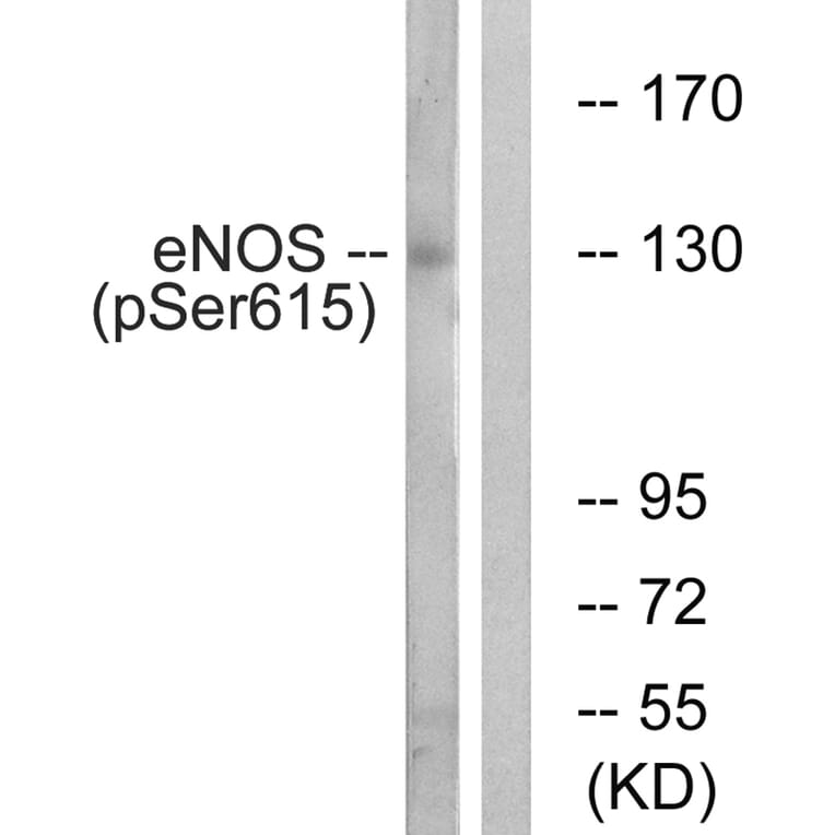 Western blot - eNOS (Phospho-Ser615) Antibody from Signalway Antibody (12137) - Antibodies.com