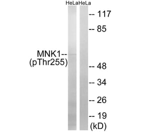Western blot - MNK1 (Phospho-Thr255) Antibody from Signalway Antibody (12142) - Antibodies.com