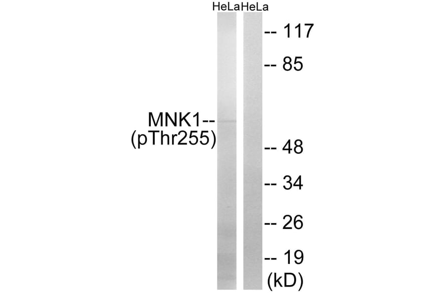 Western blot - MNK1 (Phospho-Thr255) Antibody from Signalway Antibody (12142) - Antibodies.com