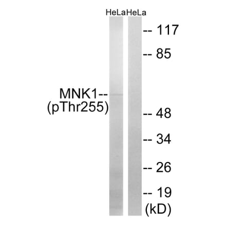Western blot - MNK1 (Phospho-Thr255) Antibody from Signalway Antibody (12142) - Antibodies.com