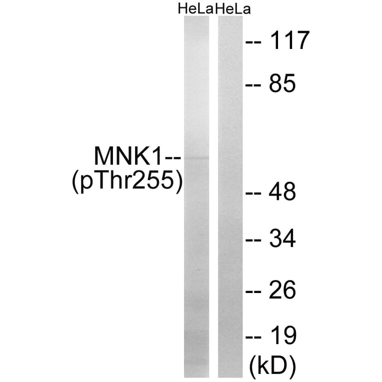 Western blot - MNK1 (Phospho-Thr255) Antibody from Signalway Antibody (12142) - Antibodies.com