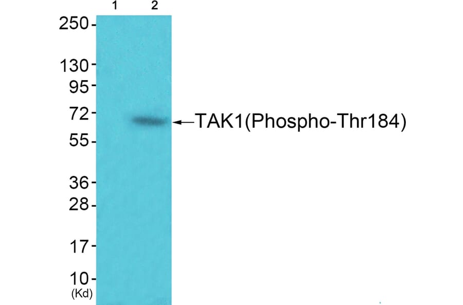 Western blot - TAK1 (Phospho-Thr184) Antibody from Signalway Antibody (12153) - Antibodies.com