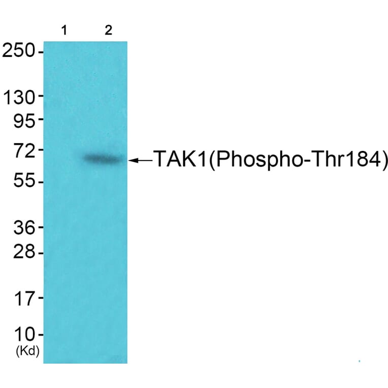 Western blot - TAK1 (Phospho-Thr184) Antibody from Signalway Antibody (12153) - Antibodies.com