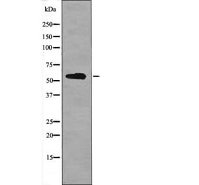 Western blot - BACE (Phospho-Ser498) Antibody from Signalway Antibody (12401) - Antibodies.com