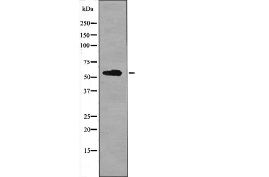 Western blot - BACE (Phospho-Ser498) Antibody from Signalway Antibody (12401) - Antibodies.com