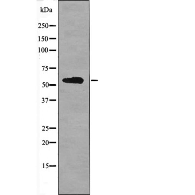 Western blot - BACE (Phospho-Ser498) Antibody from Signalway Antibody (12401) - Antibodies.com