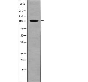 Western blot - CTIP (Phospho-Ser327) Antibody from Signalway Antibody (12402) - Antibodies.com