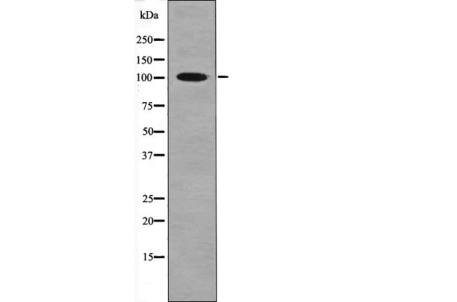 Western blot - CTIP (Phospho-Ser327) Antibody from Signalway Antibody (12402) - Antibodies.com