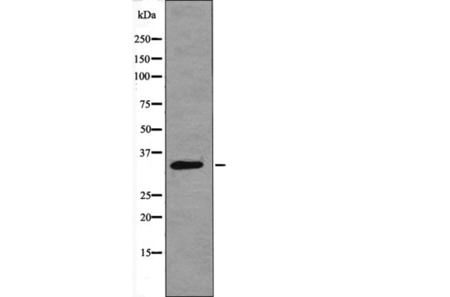 Western blot - CDK4 (Phospho-Thr172) Antibody from Signalway Antibody (12403) - Antibodies.com