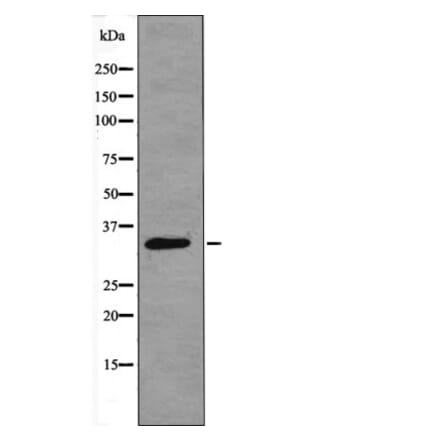 Western blot - CDK4 (Phospho-Thr172) Antibody from Signalway Antibody (12403) - Antibodies.com