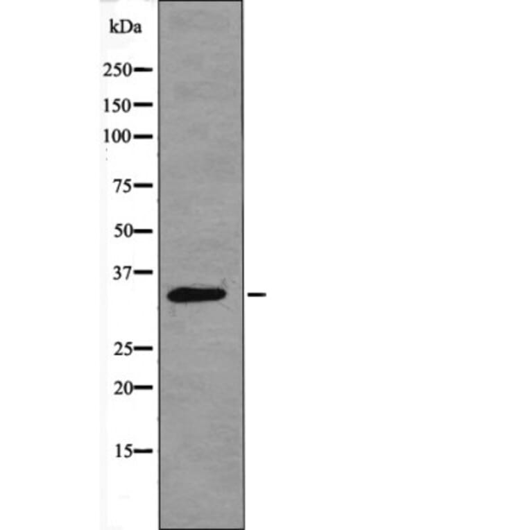 Western blot - CDK4 (Phospho-Thr172) Antibody from Signalway Antibody (12403) - Antibodies.com