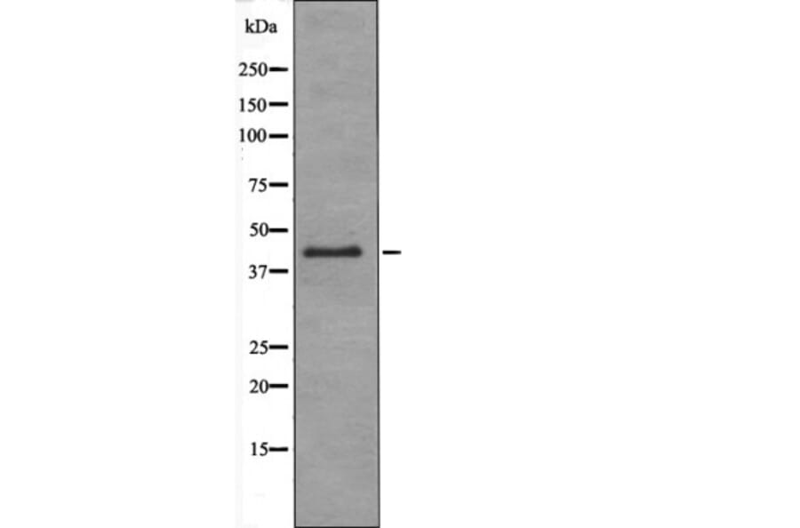 Western blot - RAD9 (Phospho-Ser272) Antibody from Signalway Antibody (12411) - Antibodies.com