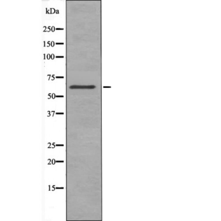 Western blot - Chk2 (Phospho-Thr432) Antibody from Signalway Antibody (12414) - Antibodies.com